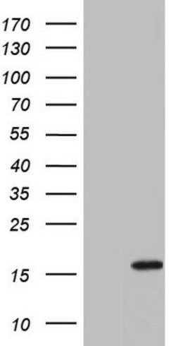 IL1RN Mouse anti-Human, Clone: OTI2B1, lyophilized, TrueMAB 100 &mu;g;