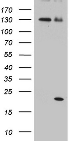 IL2 Monoclonal Antibody (OTI2C9), TrueMAB , OriGene 30 &mu;L | Buy Online | Origene Technologies | Fisher Scientific