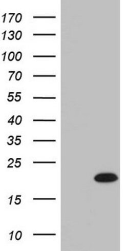 IL20 Mouse anti-Human, Clone: OTI2B8, lyophilized, TrueMAB 100 &mu;g; Unconjugated:Antibodies,