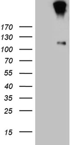 IL20RA Monoclonal Antibody (OTI7H7), TrueMAB , OriGene:Antibodies:Primary
