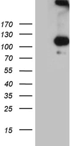 IL20RA Monoclonal Antibody (OTI1B12), TrueMAB , OriGene 100 &mu;L; Unconjugated:Antibodies,