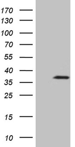 IL34 Monoclonal Antibody (OTI4A6), TrueMAB , OriGene 30 &mu;L | Buy Online | Origene Technologies | Fisher Scientific
