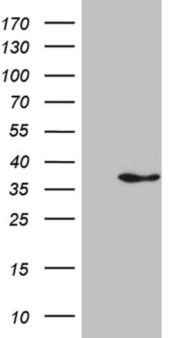 IL34 Mouse anti-Human, Clone: OTI4F2, lyophilized, TrueMAB 100 &mu;g; Unconjugated:Antibodies,