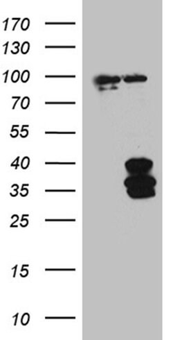 IL34 Mouse anti-Human, Clone: OTI5E1, TrueMAB , Origene 30 &mu;L; Unconjugated:Antibodies,