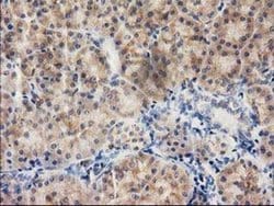 ILVBL Monoclonal Antibody (OTI1A12), TrueMAB , OriGene 100 &mu;L; Unconjugated:Antibodies,