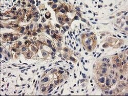 ILVBL Monoclonal Antibody (OTI1A12), TrueMAB , OriGene:Antibodies:Primary