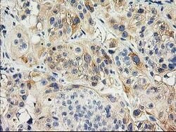 ILVBL Mouse anti-Human, Clone: OTI4E4, lyophilized, TrueMAB 100 &mu;g | Buy Online | OriGene | Fisher Scientific