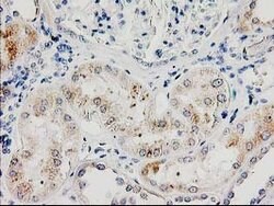 ILVBL Mouse anti-Human, Clone: OTI4E4, lyophilized, TrueMAB 100 &mu;g | Buy Online | OriGene | Fisher Scientific