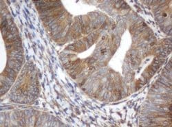 ILVBL Monoclonal Antibody (OTI3E9), TrueMAB , OriGene 100 &mu;L; Unconjugated:Antibodies,