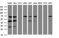 ILVBL Mouse anti-Human, Clone: OTI3E9, lyophilized, TrueMAB 100 &mu;g;