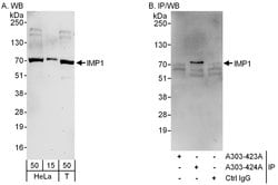IMP1 Rabbit anti-Human, Polyclonal, Bethyl Laboratories 100 &mu;L; Unconjugated:Antibodies,