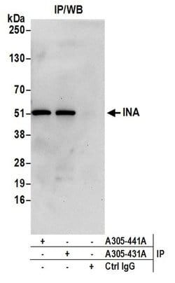 INA Rabbit anti-Human, Polyclonal, Bethyl Laboratories 10 &mu;L | Buy Online | Bethyl Laboratories, Inc | Fisher Scientific