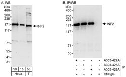INF2 Rabbit anti-Human, Polyclonal, Bethyl Laboratories 100 &mu;L; Unconjugated:Antibodies,