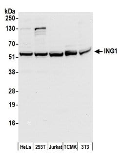ING1 Polyclonal Antibody, Bethyl Laboratories 20 &mu;L; Unconjugated:Antibodies,