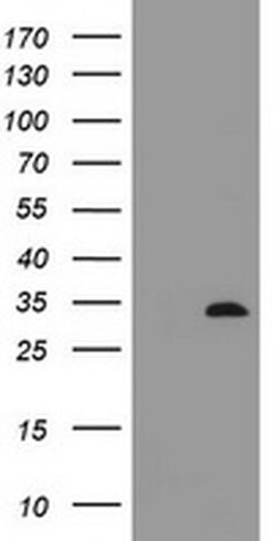 ING2 Monoclonal Antibody (OTI4G10), TrueMAB , OriGene:Antibodies:Primary