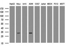 ING2 Monoclonal Antibody (OTI4G10), TrueMAB , OriGene 100 &mu;L; Unconjugated:Antibodies,