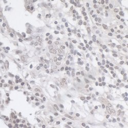 INT11 Rabbit anti-Human, Mouse, Polyclonal, Bethyl Laboratories 100 &mu;L;