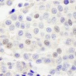 INT4 Polyclonal Antibody, Bethyl Laboratories 100 &mu;L; Unconjugated:Antibodies,