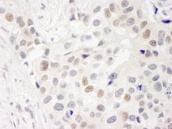 INT7 Polyclonal Antibody, Bethyl Laboratories 10 &mu;L; Unconjugated:Antibodies,