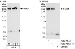 IP3R1 Rabbit anti-Human, Mouse, Polyclonal, Bethyl Laboratories 100 &mu;l;