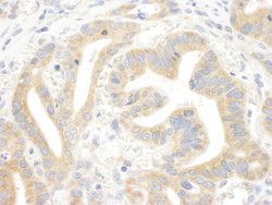 IP3R3 Polyclonal Antibody, Bethyl Laboratories:Antibodies:Primary Antibodies