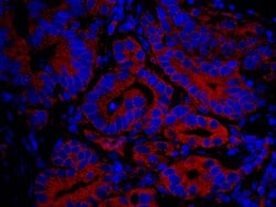 IP3R3 Polyclonal Antibody, Bethyl Laboratories 10 &mu;L; Unconjugated:Antibodies,