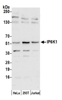 IP6K1 Polyclonal Antibody, Bethyl Laboratories 20 &mu;L; Unconjugated:Antibodies,