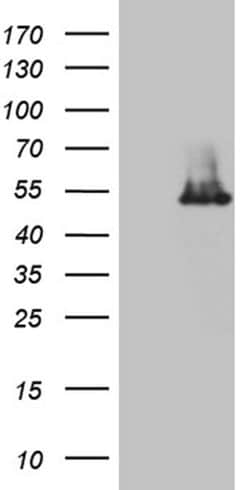 IP6K2 Monoclonal Antibody (OTI1F12), TrueMAB , OriGene 100 &mu;L | Buy Online | OriGene | Fisher Scientific