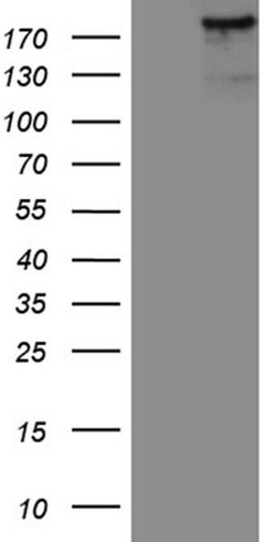 IQGAP1 Monoclonal Antibody (OTI6E1), TrueMAB , OriGene:Antibodies:Primary