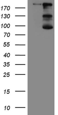 IQGAP1 Monoclonal Antibody (OTI5F9), TrueMAB , OriGene 30 &mu;L | Buy Online | Origene Technologies | Fisher Scientific