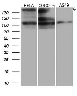 IQGAP1 Monoclonal Antibody (OTI5F9), TrueMAB , OriGene 30 &mu;L | Buy Online | Origene Technologies | Fisher Scientific