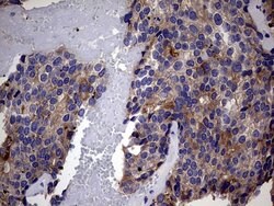 IRAK2 Mouse anti-Human, Clone: OTI4C1, lyophilized, TrueMAB 100 &mu;g;