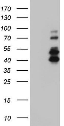 IRAK2 Mouse anti-Human, Clone: OTI1D4, lyophilized, TrueMAB 100 &mu;g;