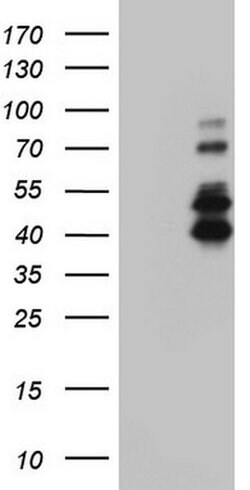 IRAK2 Monoclonal Antibody (OTI1D4), TrueMAB , OriGene:Antibodies:Primary