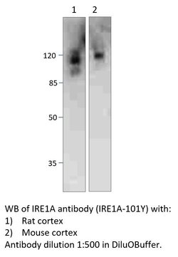IRE1A Chicken anti-Human, Mouse, Rat, Polyclonal, FabGennix 200 &mu;L;