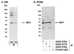 IRF1 Rabbit anti-Mouse, Polyclonal, Bethyl Laboratories 100 &mu;L; Unconjugated:Antibodies,