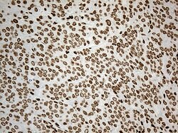 IRF2BP1 Monoclonal Antibody (OTI3A6), TrueMAB , OriGene 100 &mu;L; Unconjugated:Antibodies,