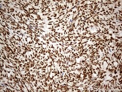 IRF2BP1 Monoclonal Antibody (OTI5H7), TrueMAB , OriGene 100 &mu;L; Unconjugated:Antibodies,