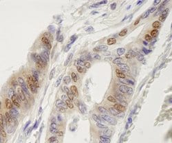 IRF3 Polyclonal Antibody, Bethyl Laboratories 10 &mu;L; Unconjugated:Antibodies,