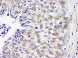 IRF3 Polyclonal Antibody, Bethyl Laboratories 10 &mu;L; Unconjugated:Antibodies,