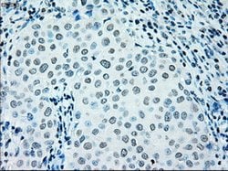 IRF3 Mouse anti-Human, Clone: OTI5D2, lyophilized, TrueMAB 100 &mu;g; Unconjugated:Antibodies,