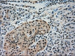 IRF3 Mouse anti-Human, Clone: OTI4D4, lyophilized, TrueMAB 100 &mu;g; Unconjugated:Antibodies,