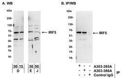 IRF5 Rabbit anti-Human, Mouse, Polyclonal, Bethyl Laboratories 100 &mu;L;