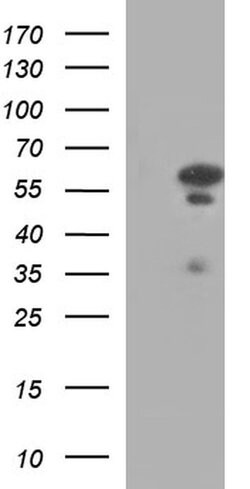 IRF5 Monoclonal Antibody (OTI1A5), TrueMAB , OriGene:Antibodies:Primary