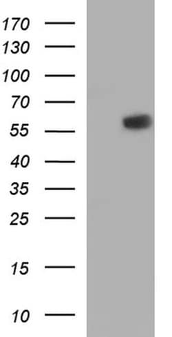 IRF5 Monoclonal Antibody (OTI1B8), TrueMAB , OriGene:Antibodies:Primary