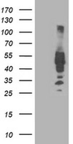 IRF6 Monoclonal Antibody (OTI1D4), TrueMAB , OriGene 100 &mu;L; Unconjugated:Antibodies,