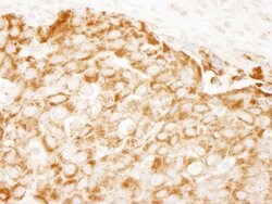 IRS1 Rabbit anti-Human, Mouse, Polyclonal, Bethyl Laboratories 100 &mu;L;
