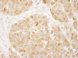 IRS1 Polyclonal Antibody, Bethyl Laboratories 10 &mu;L; Unconjugated:Antibodies,