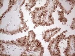IRS1 Monoclonal Antibody (OTI9E11), TrueMAB , OriGene 100 &mu;L; Unconjugated:Antibodies,