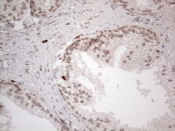 IRS1 Monoclonal Antibody (OTI9E11), TrueMAB , OriGene 100 &mu;L; Unconjugated:Antibodies,